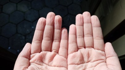 Dlaczego na palcach po kąpieli pojawiają się zmarszczki? Zaskakujące fakty