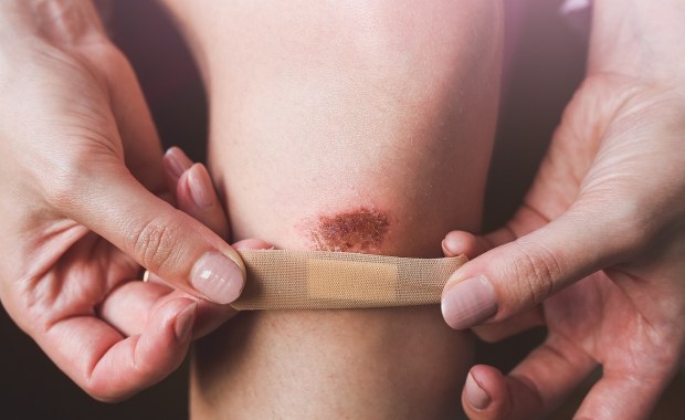 Dlaczego nasze rany goją się tak wolno? Oto, co odkryli naukowcy