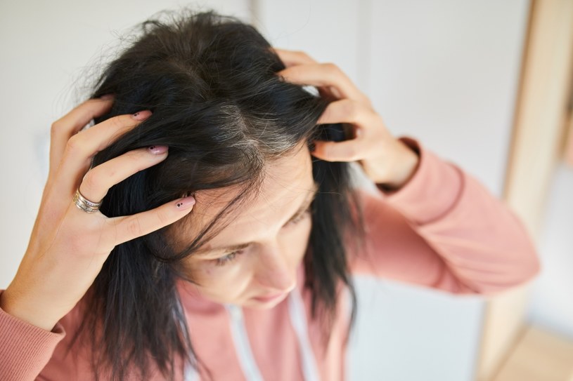 Dlaczego włosy wypadają garściami? Winne mogą być nasze codzienne nawyki, choroba czy wzmożony stres /123RF/PICSEL