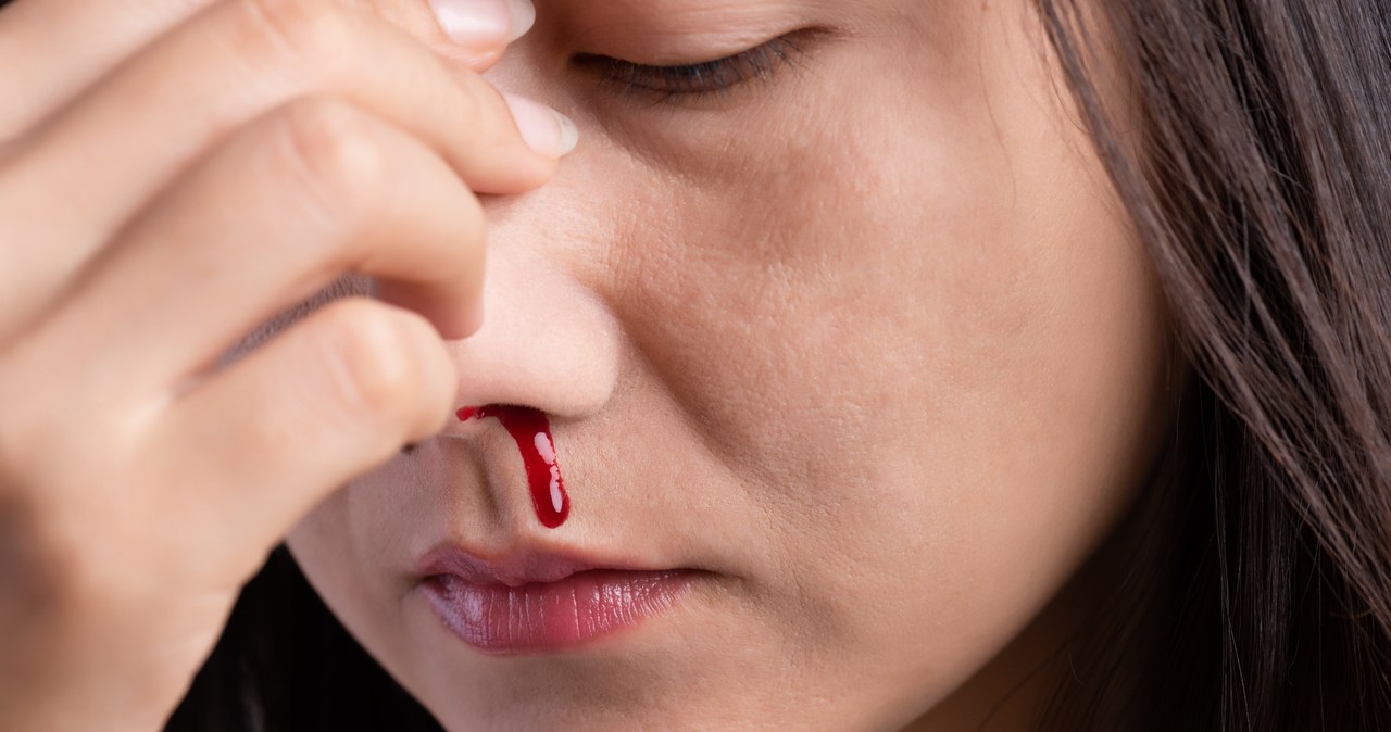 Dłubanie w nosie może prowadzić do wystąpienia krwawienia /123RF/PICSEL