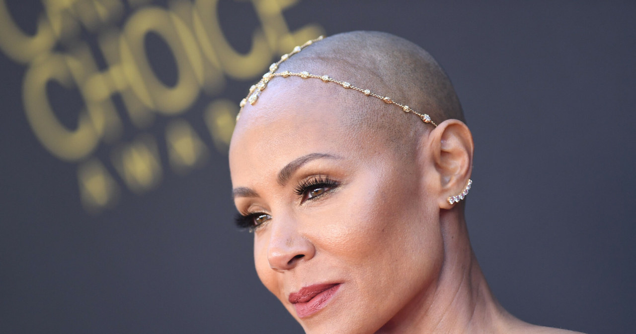 Do łysienia plackowatego przyznała się  Jada Pinkett Smith, żona znanego aktora Willa Smitha /123RF/PICSEL