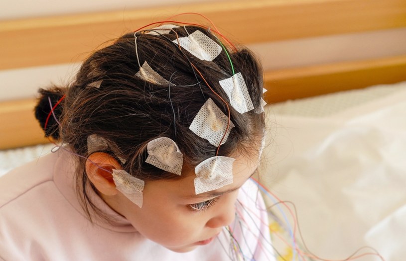 Do postawienia diagnozy padaczki niezbędne jest wykonanie badania czynności elektrycznej mózgu, czyli EEG /123RF/PICSEL