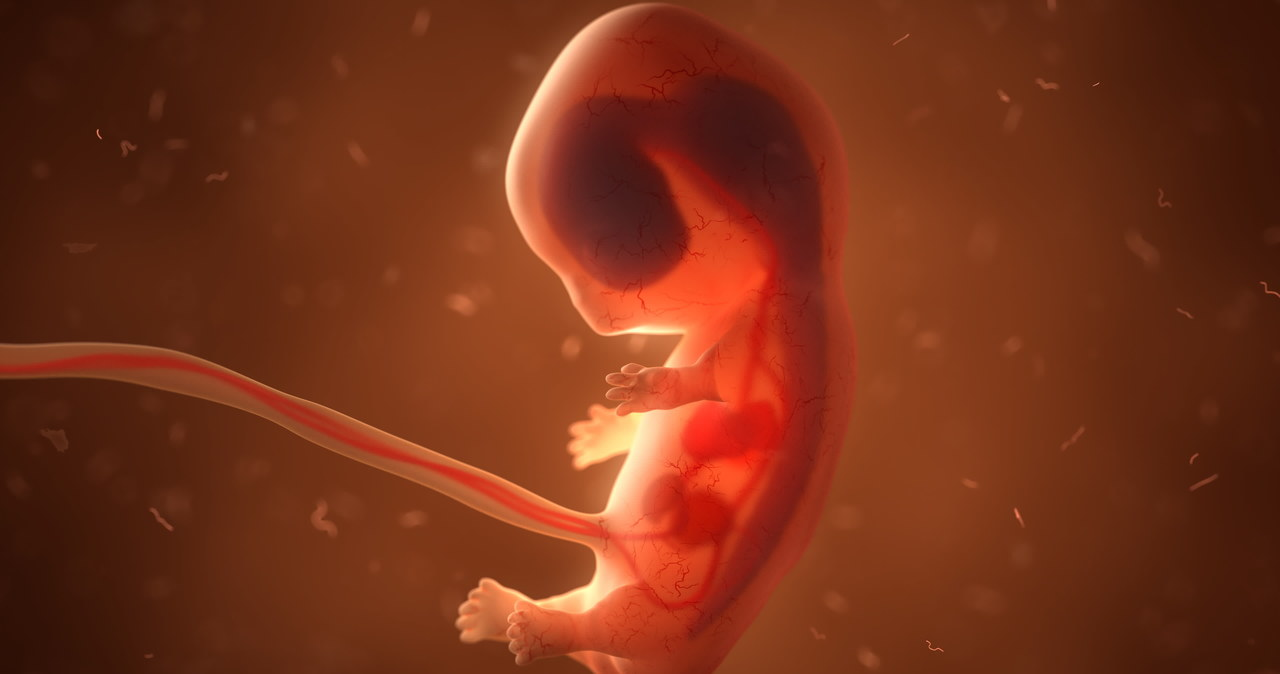 Do przypadków fetus in fetu dochodzi raz na 500 000 ciąż /123RF/PICSEL