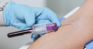 Dodatkowy dzień urlopu na badania? Jest petycja