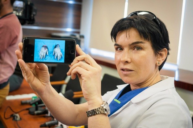 Doktor Anna Chrapusta prezentuje dziennikarzom zdjęcie odciętych dłoni /Łukasz Krajewski /