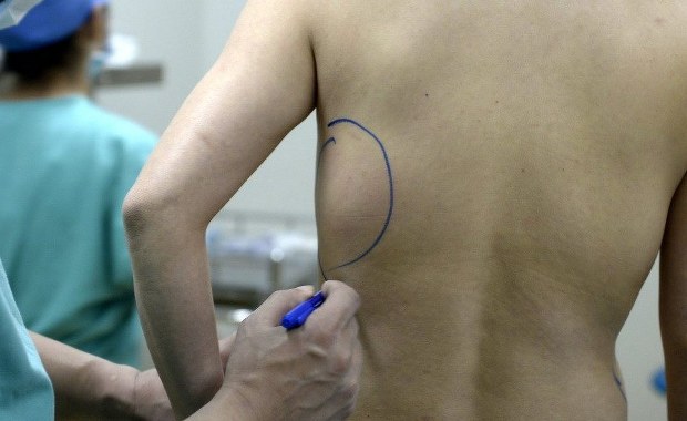 "Doktor Frankenstein" zatrzymana. Oszpecała pacjentów, niektórzy trafiali do szpitali