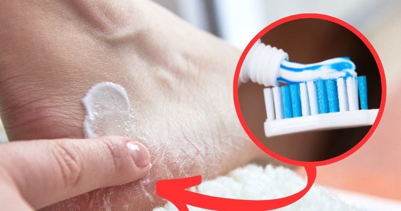Domowa "pasta do zębów" pomoże ci wygładzić stopy bez wydawania pieniędzy na zabiegi w salonach kosmetycznych /Pixel
