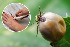 Domowe sposoby na kleszcze. Będą się trzymały od ciebie z daleka