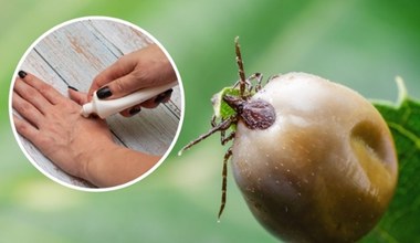 Domowe sposoby na kleszcze. Będą się trzymały od ciebie z daleka