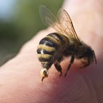 Domowe sposoby na użądlenie pszczoły