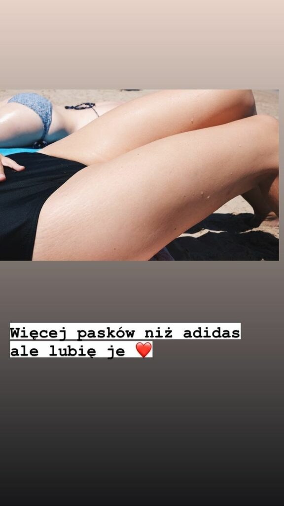 Dorota Szelągowska pokazała rozstępy na udach /Instagram