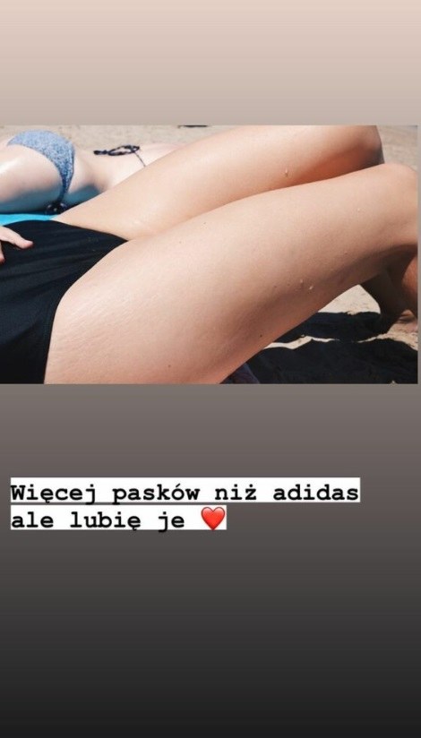 Dorota Szelągowska pokazała rozstępy w social mediach. /Instagram / dotindotin /Instagram
