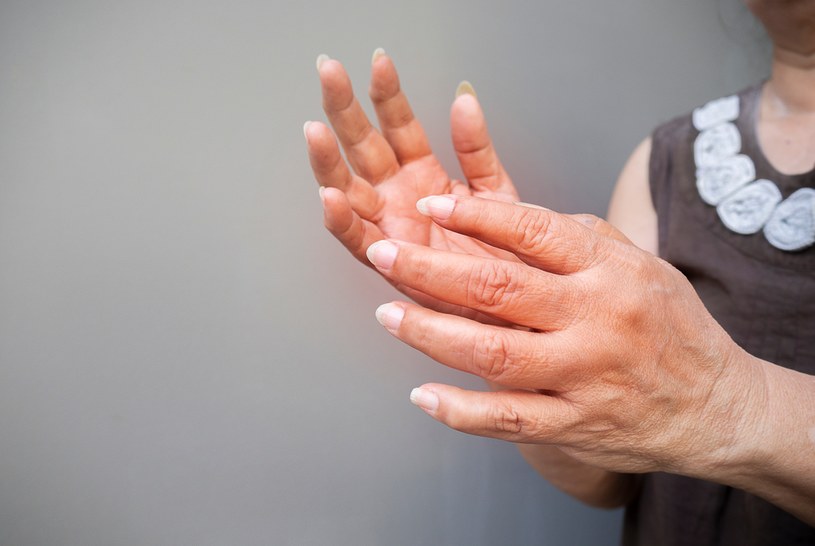 Drętwienie rąk zwykle bywa bagatelizowane /123RF/PICSEL