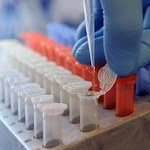 Drugi w Polsce potwierdzony przypadek zakażenia bakterią E.coli