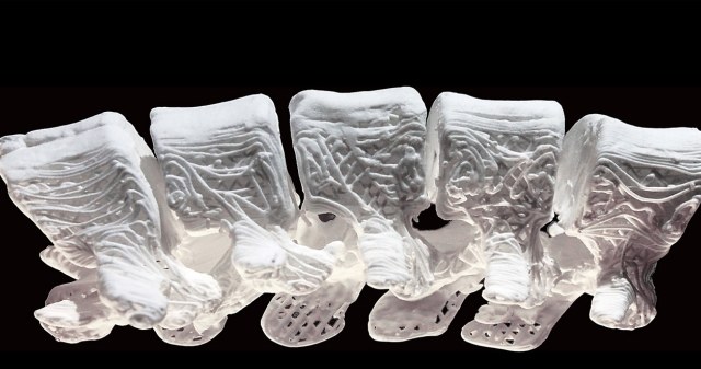 Drukarka 3D pomoże w łączeniu uszkodzonych kości /materiały prasowe