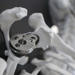 Drukowane kości? Polscy naukowcy pracują nad nowatorskim pomysłem