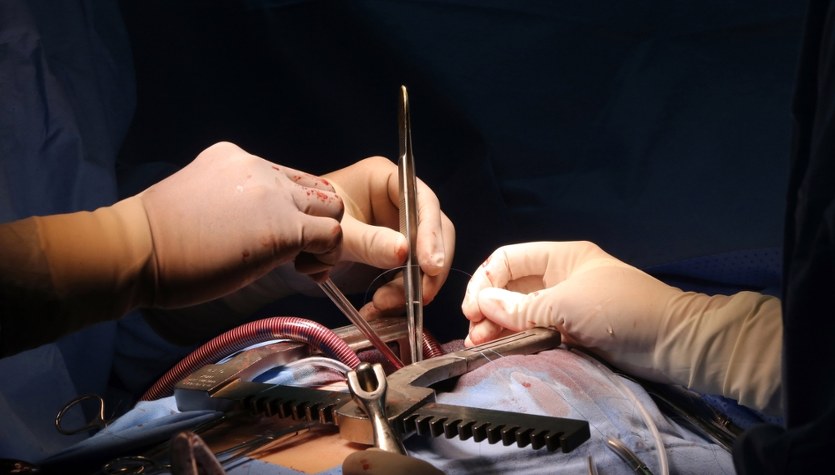 Dwa zabiegi naraz, by uniknąć nowego udaru. Śląski szpital z wyjątkową procedurą