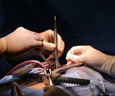 Dwa zabiegi naraz, by uniknąć nowego udaru. Śląski szpital z wyjątkową procedurą