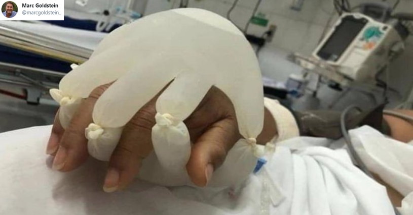 Dwie rękawiczki i ciepła woda na dłoni pacjenta z COVID-19 - jedno ze zdjęć, które obiegło świat /Twitter