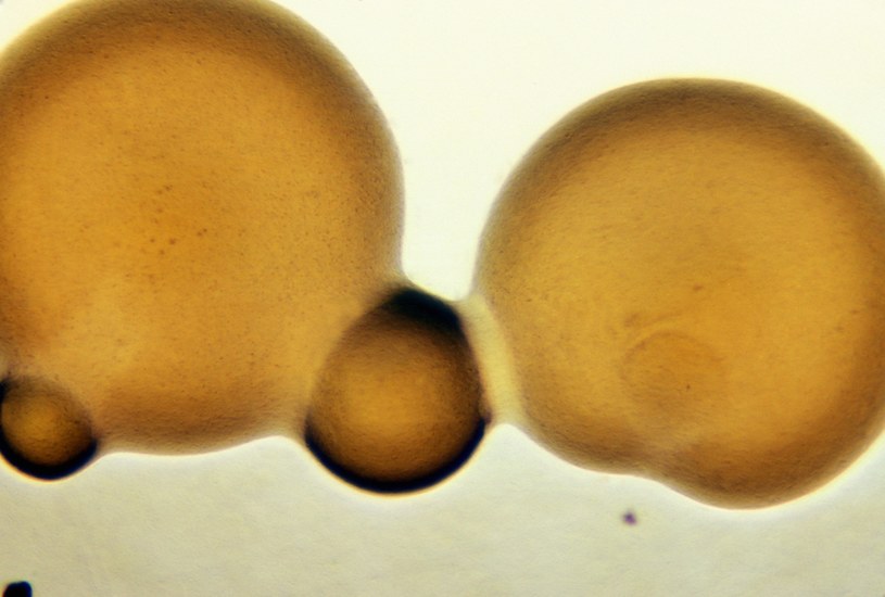 Dwoinki rzeżączki (Neisseria gonorrhoeae) coraz częściej oporne są na działanie antybiotyków /Smith Collection/Gado /Getty Images