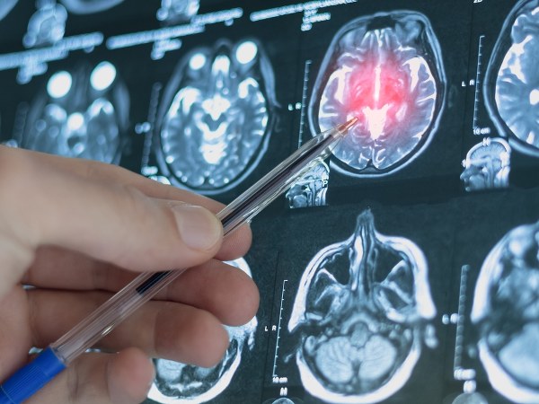 <span class="extra">Dyżur eksperta</span>Kiedy bomba tyka? Wykryj zanim wybuchnie