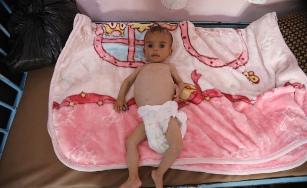 ​Dzieci konają z głodu w Strefie Gazy. "Pojawił się nowy zabójca"