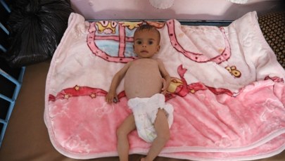 ​Dzieci konają z głodu w Strefie Gazy. "Pojawił się nowy zabójca"