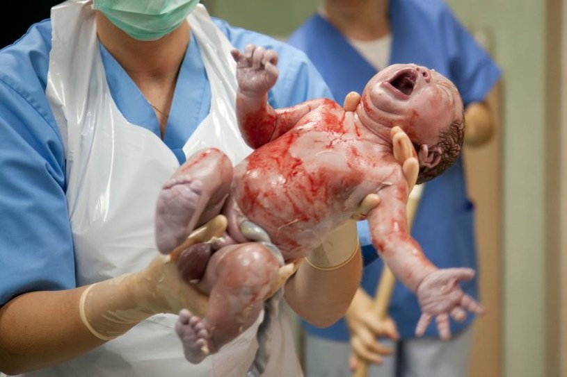 Dzieci urodzone w wyniku cięcia cesarskiego są bardziej narażone na wystąpienie niektórych chorób /123RF/PICSEL