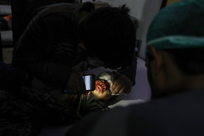 Dziecko ranne w wyniku bombardowania we Wschodniej Ghucie /MOHAMMED BADRA /PAP/EPA