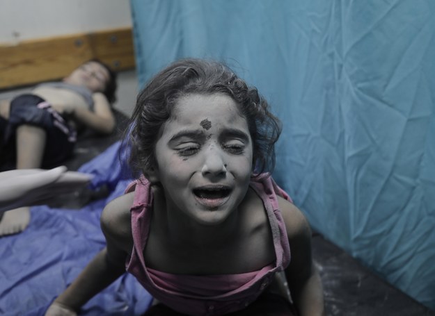 Dziewczynka ranna podczas wybuchu w szpitalu w Gazie /HAITHAM IMAD /PAP/EPA