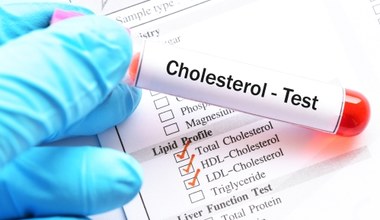 Dziewięć produktów na zbicie cholesterolu. Jedz, a poprawisz wyniki 