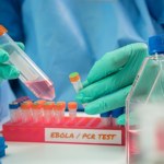 wirus Ebola Ebola rozszerza się poza Afrykę? Podejrzenie u pacjenta w Brazylii