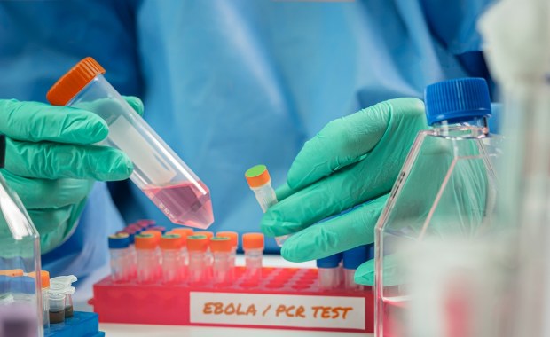 Ebola rozszerza się poza Afrykę? Podejrzenie u pacjenta w Brazylii