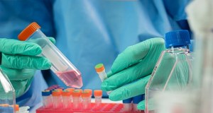 Ebola rozszerza się poza Afrykę? Podejrzenie u pacjenta w Brazylii