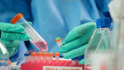 Ebola rozszerza się poza Afrykę? Podejrzenie u pacjenta w Brazylii