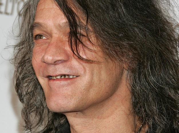 eddie van halen missing teeth