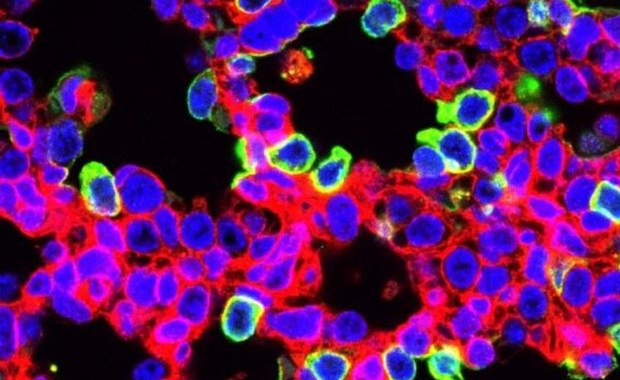 Edycja genów jeszcze w łonie matki. To może być sposób na mukowiscydozę