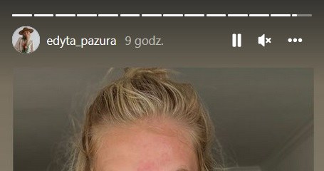 Edyta Pazura przestrzega innych, aby używać filtrów /www.instagram.com/edyta_pazura /Instagram