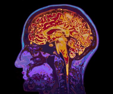 EEG nie tylko w diagnostyce padaczki. Dobry neurolog zleci je po udarze mózgu lub urazie głowy