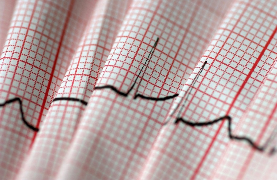 Porażające statystyki. Niewydolność serca to już epidemia?