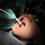 Eksperci alarmują: 4 mld ludzi na świecie ma obecnie jakąś chorobę jamy ustnej