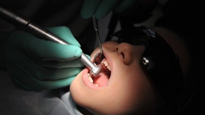 Eksperci alarmują: 4 mld ludzi na świecie ma obecnie jakąś chorobę jamy ustnej