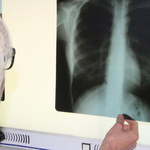Eksperci: Płuca chorego na POChP są jak źle nadmuchany balon