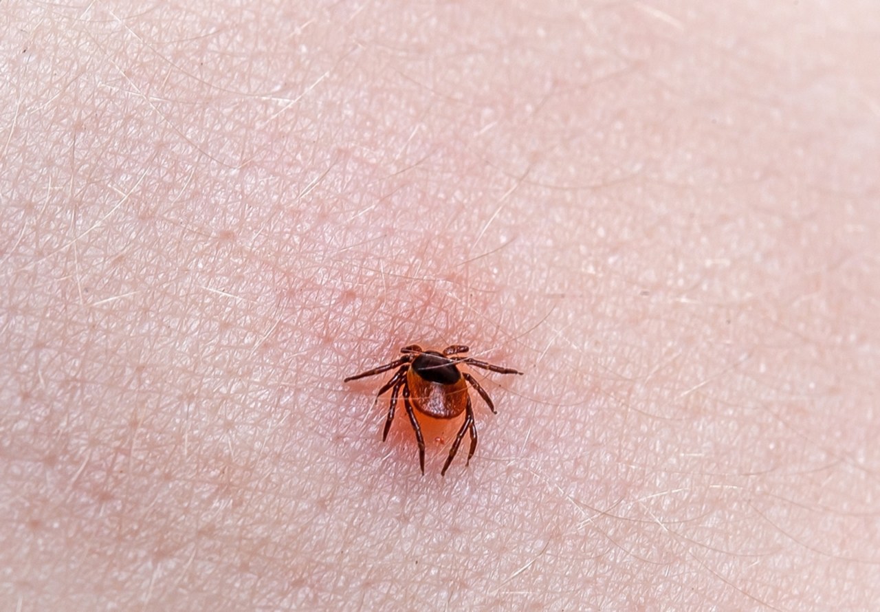 Ekspertka: Mamy szczyt sezonu zakażeń boreliozą