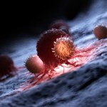 Eksperymentalna terapia i rak zniknął. Niezwykły przypadek 3-latka