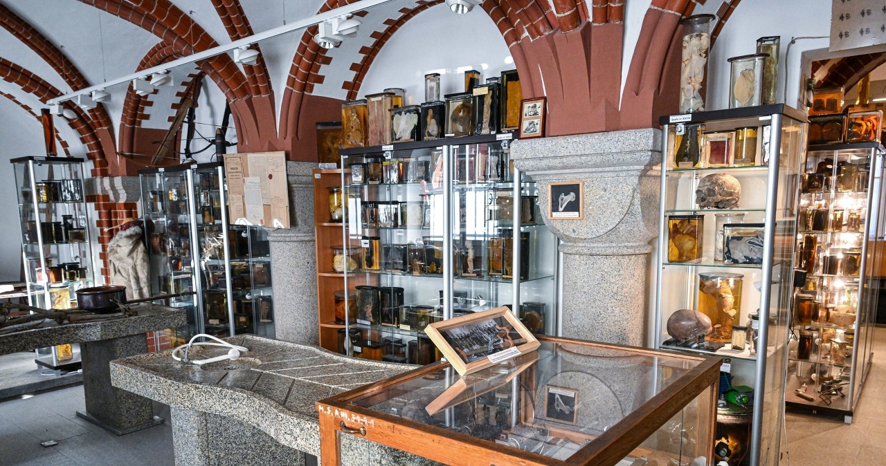 Eksponaty w Muzeum Medycyny Sądowej Uniwersytetu Medycznego