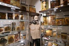 Eksponaty w Muzeum Medycyny Sądowej Uniwersytetu Medycznego