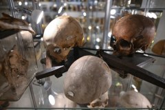 Eksponaty w Muzeum Medycyny Sądowej Uniwersytetu Medycznego