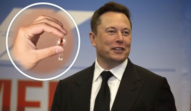 Elon Musk to zrobił. Implant Neuralink w mózgu pierwszego pacjenta