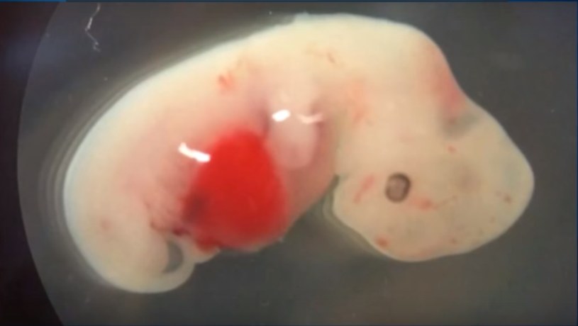 Embrion świnio-człowieka po czerech tygodniach rozwoju /YouTube